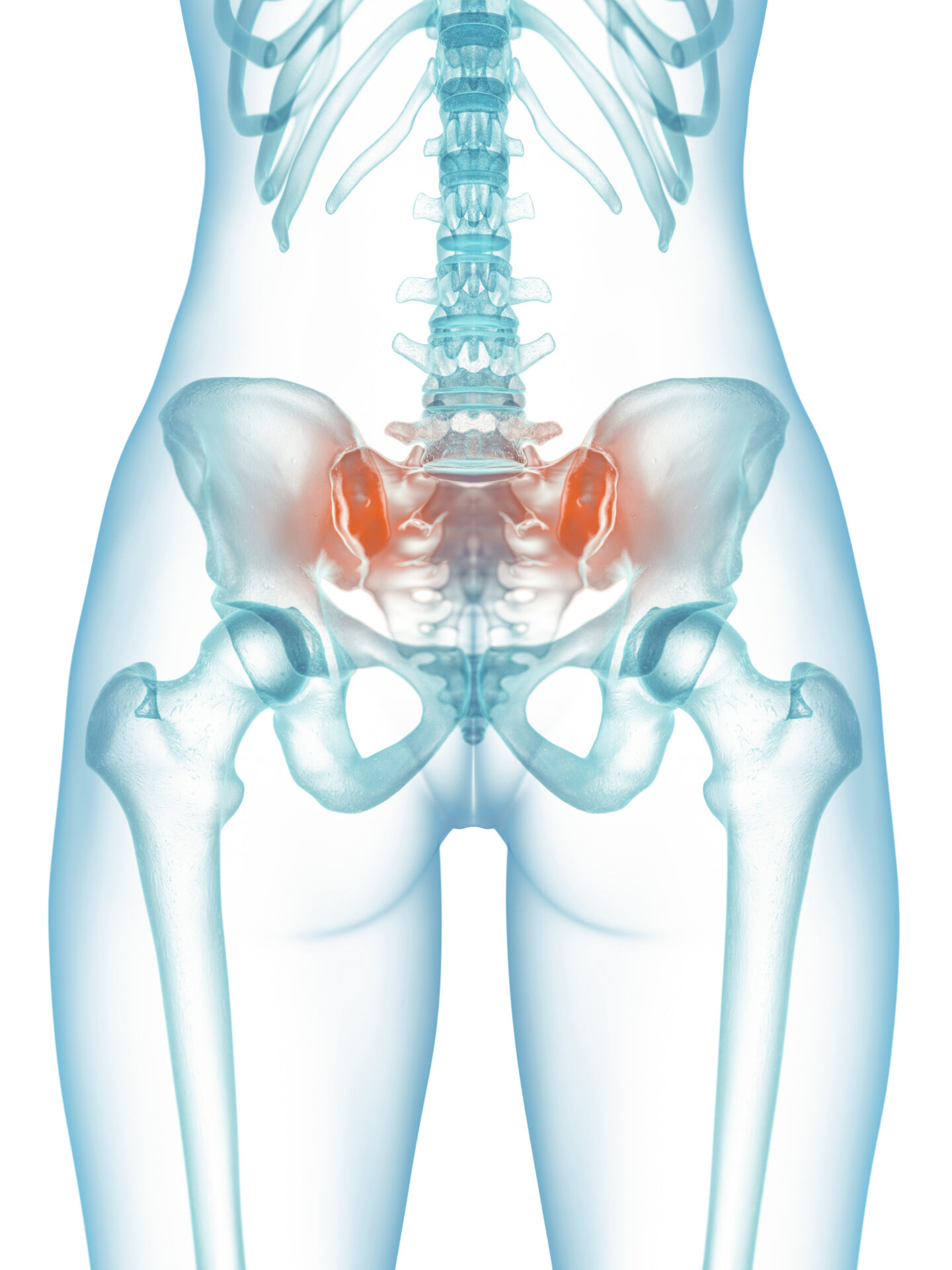 3d rendered medically accurate illustration of a painful sacroil 3d rendered medically accurate illustration of a painful sacroil