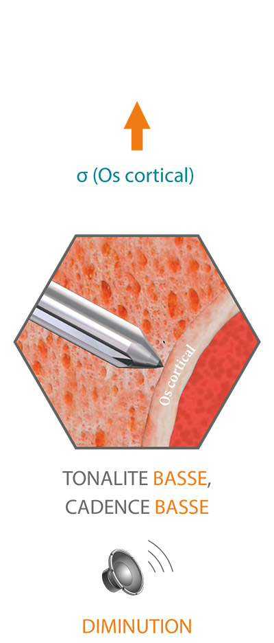 SpineGuard faible hauteur
