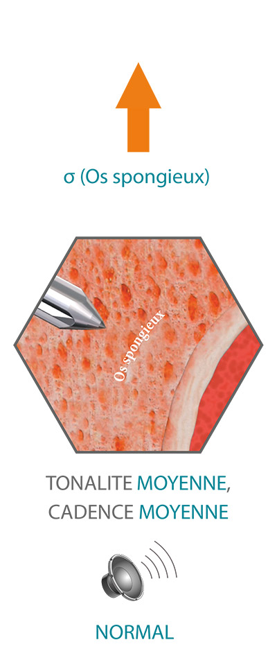SpineGuard-Normal-pitch-fr