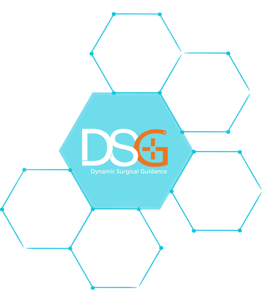 Spineguard DSG Technology