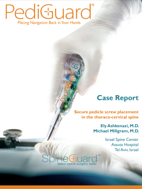 SpineGuard | Brochures